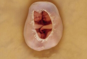 ̥̕r(sh)̥ʲôX