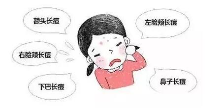 (x)Ta(chn)ô 
