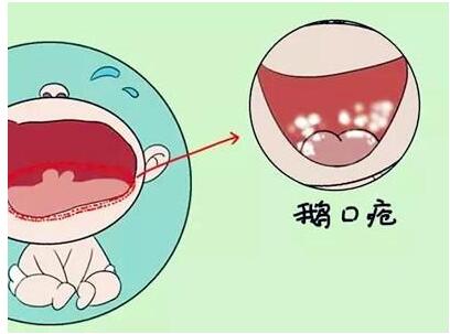 Zگô