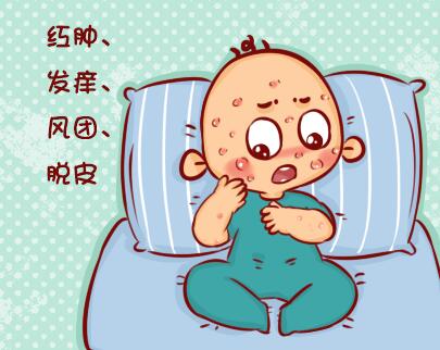 Ӟʲô(hu)^(gu)Ƥӷ